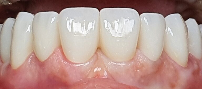 20230303 020225 768x338