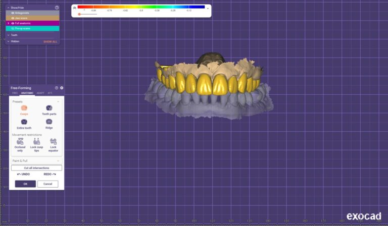 IMG 78dd130e787d9480a31204686af76131 V 768x448