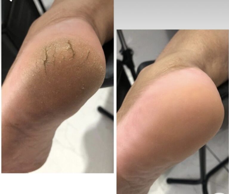 2024 03 22 5 768x652